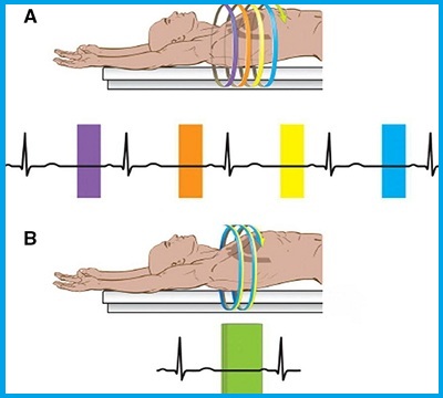 مجهز به سیستم Gated Spect